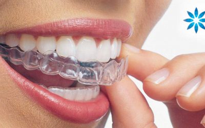 Huntington Beach Invisalign® Preferred Provider