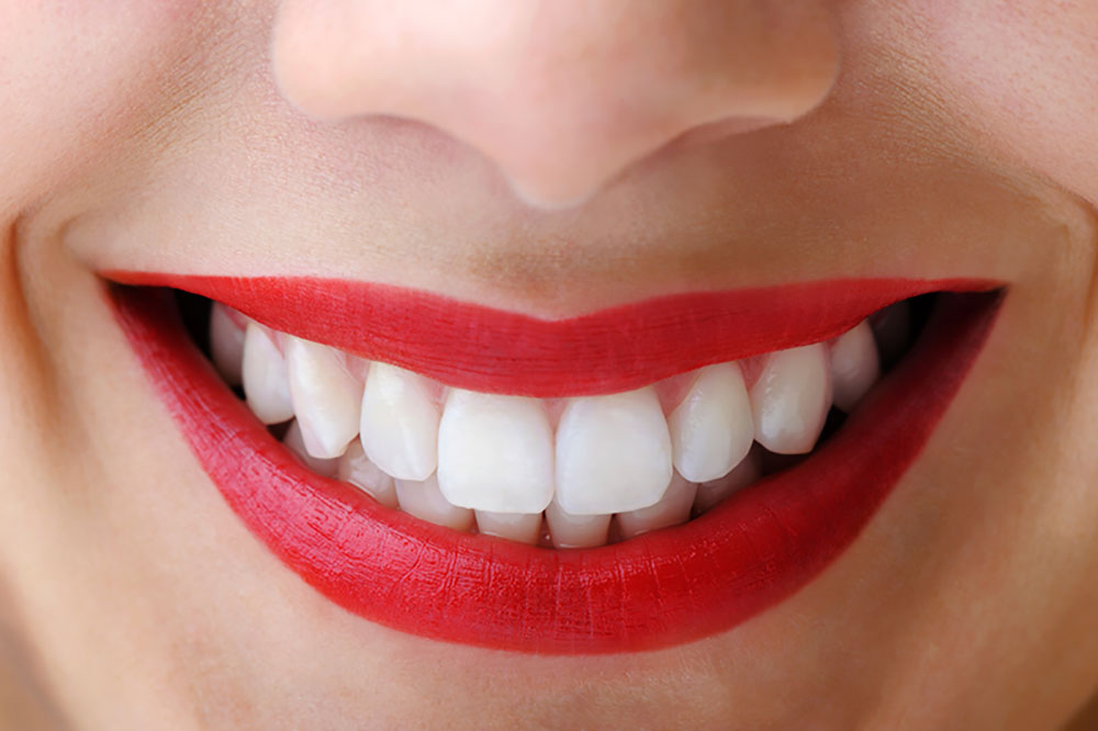 Great teeth cleanings, equals a bright white smile.